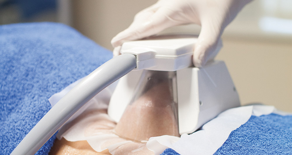 Multiple Areas in One Session HIFU and Fat Freezing Arundel