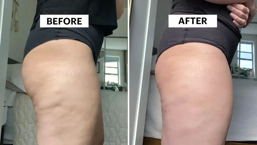 Do Toning Exercise Arundel Really Tackle Cellulite?