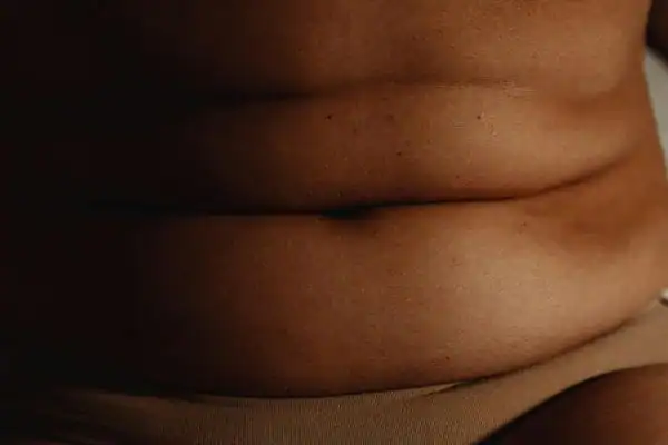 The Hidden Connection: How Stress Shapes Your Fitness and Body Composition 3 image of what stress can do on the stomach area and how Lipo 360 Arundel can help to change your body shape.