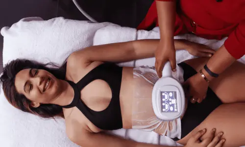 Woman having Body Sculpting treatment post injury Arundel